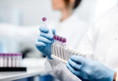 Blíží se konec platnosti normy ČSN EN ISO 15189:2013